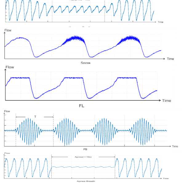 Event Detection