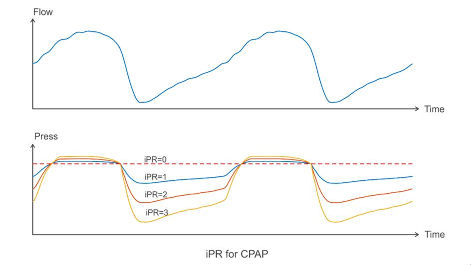 Unique Expiratory